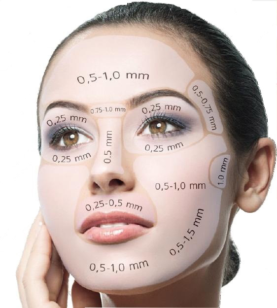 Рекомендательные значения длины иглы мезороллера в зависимости от зоны кожи лица
